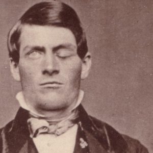 Phineas Gage