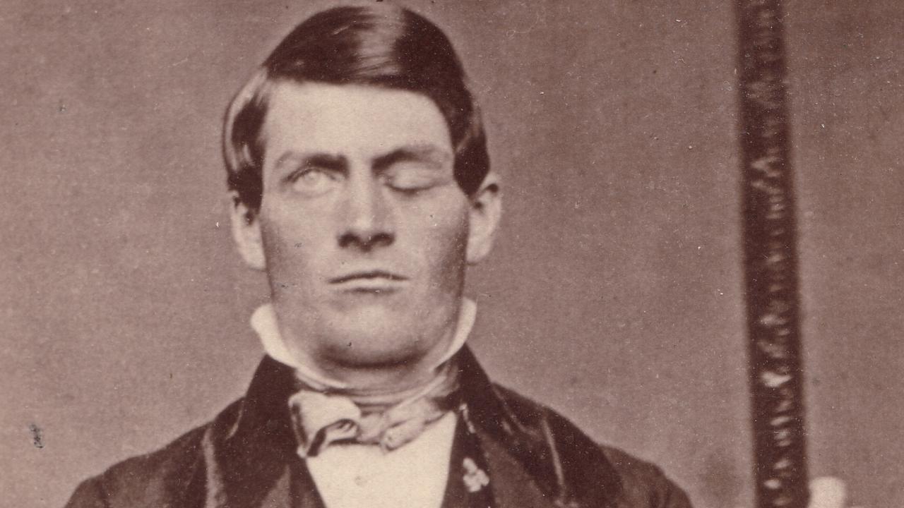 Phineas Gage